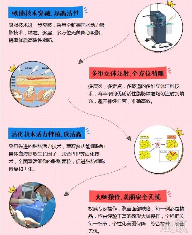 https://img.miyanlife.com/mnt/timg/181110/1300264037-8.jpg