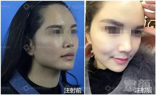 https://img.miyanlife.com/mnt/timg/181110/135QA118-3.jpg