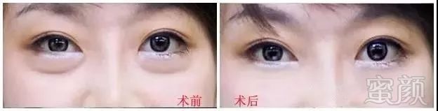 https://img.miyanlife.com/mnt/timg/181112/105JC602-3.jpg