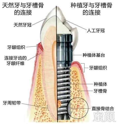 案例图片