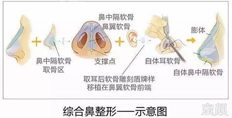 案例图片