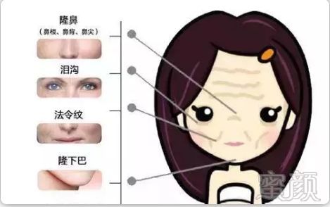 https://img.miyanlife.com/mnt/timg/181113/1203303448-7.jpg