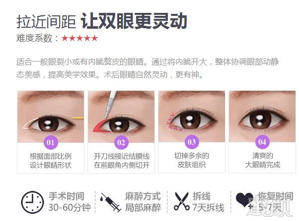 https://img.miyanlife.com/mnt/timg/181113/130SID1-4.jpg