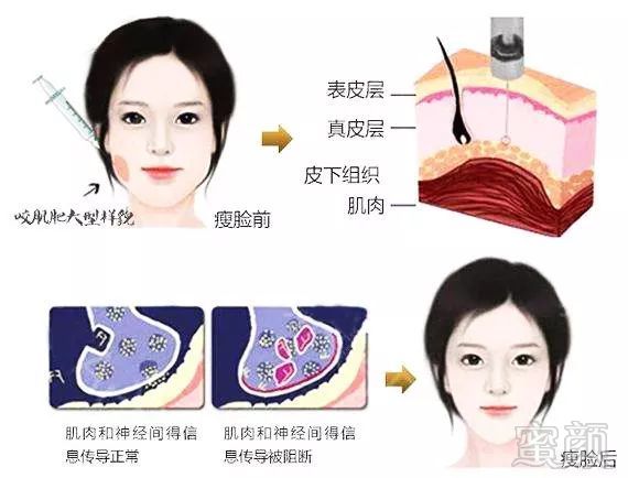 https://img.miyanlife.com/mnt/timg/181113/13240W308-4.jpg