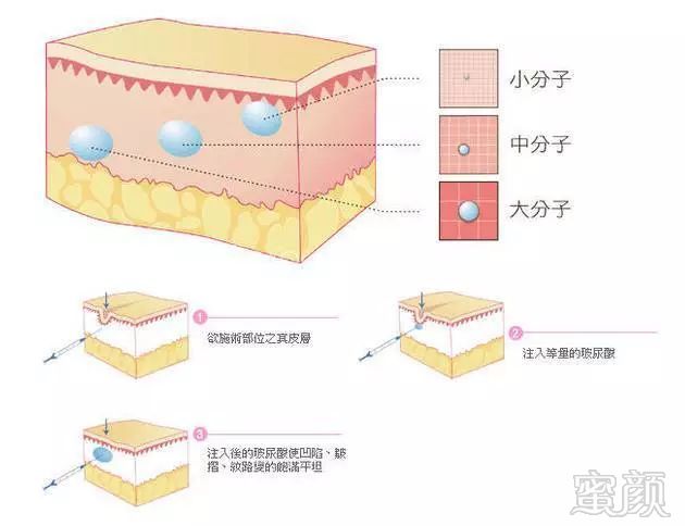 https://img.miyanlife.com/mnt/timg/181114/114603L54-2.jpg