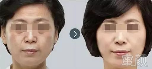 https://img.miyanlife.com/mnt/timg/181114/1214354S8-4.jpg