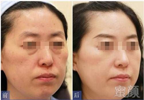 https://img.miyanlife.com/mnt/timg/181114/1214361948-8.jpg