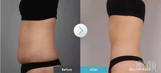 https://img.miyanlife.com/mnt/timg/181114/1214363N0-10.jpg