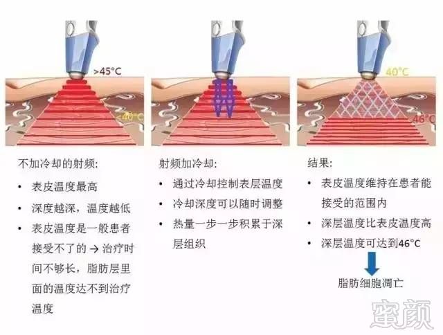 https://img.miyanlife.com/mnt/timg/181114/12143A009-6.jpg