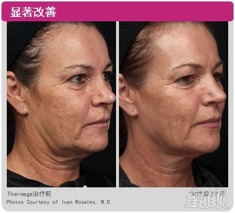 https://img.miyanlife.com/mnt/timg/181115/1216095007-10.jpg