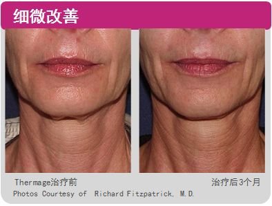 https://img.miyanlife.com/mnt/timg/181115/12160R525-8.jpg