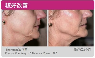 https://img.miyanlife.com/mnt/timg/181115/12160WA8-9.jpg