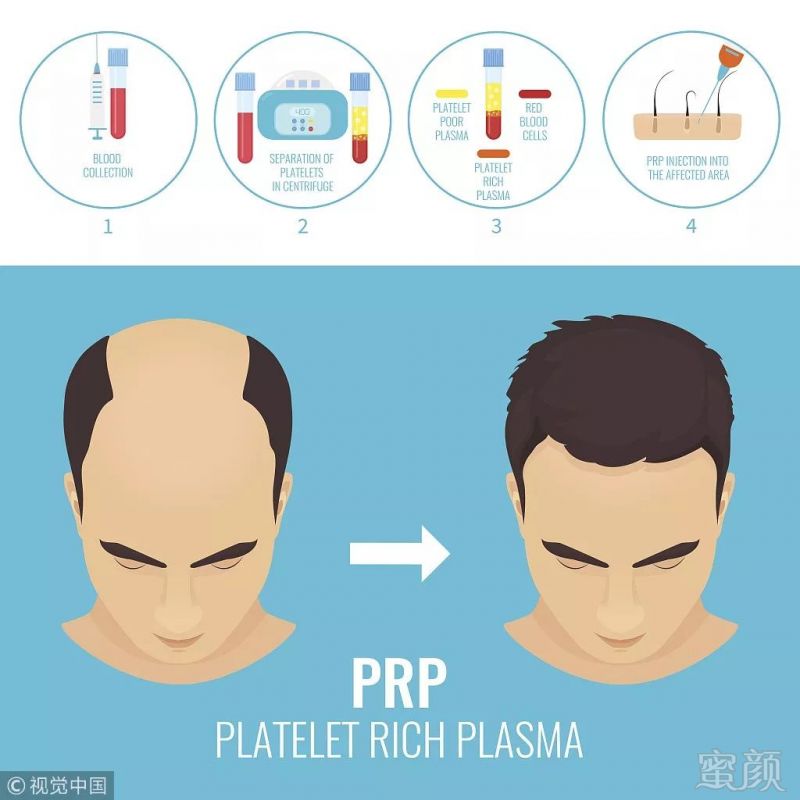 https://img.miyanlife.com/mnt/timg/181116/10464213U-1.jpg