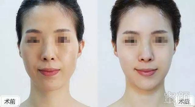 https://img.miyanlife.com/mnt/timg/181116/1122004H2-4.jpg