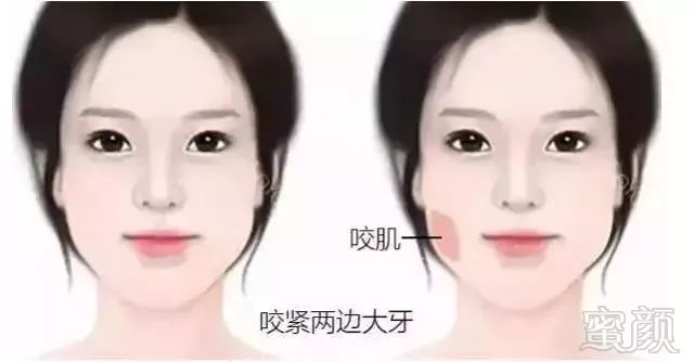 https://img.miyanlife.com/mnt/timg/181116/1122563c8-4.jpg