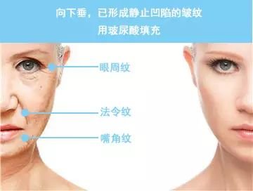 https://img.miyanlife.com/mnt/timg/181116/12005211K-5.jpg