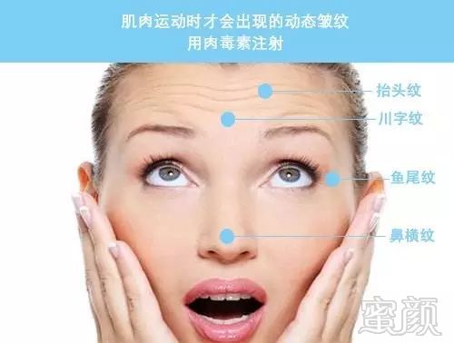 https://img.miyanlife.com/mnt/timg/181116/1200521L3-6.jpg