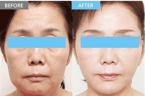 https://img.miyanlife.com/mnt/timg/181116/1200525245-8.jpg