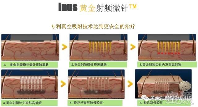 案例图片