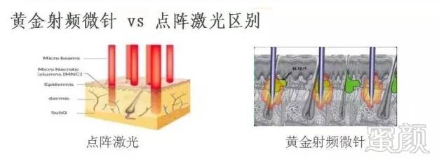 案例图片