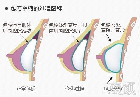 案例图片