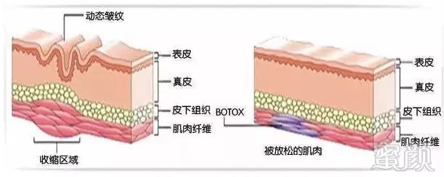 案例图片