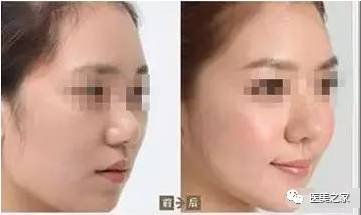 https://img.miyanlife.com/mnt/timg/181117/094235FZ-7.jpg