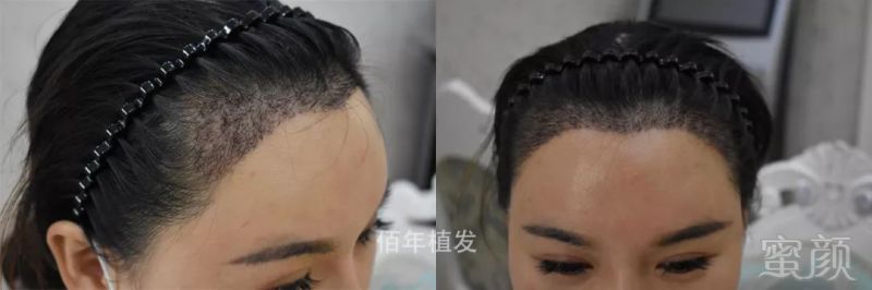 https://img.miyanlife.com/mnt/timg/181117/0949442N1-2.jpg