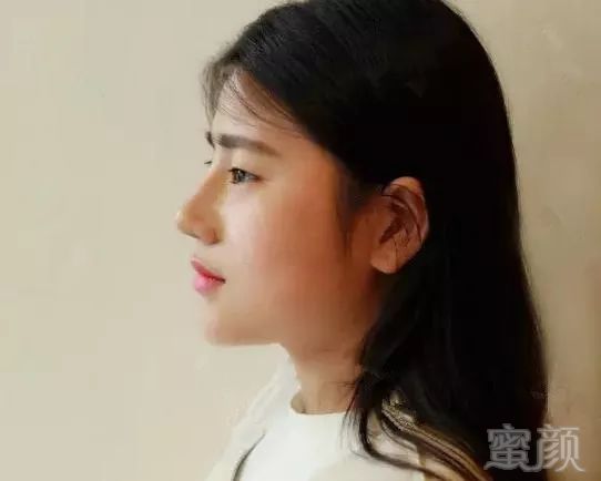 https://img.miyanlife.com/mnt/timg/181117/1010195233-3.jpg