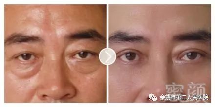 https://img.miyanlife.com/mnt/timg/181117/10102W209-1.jpg