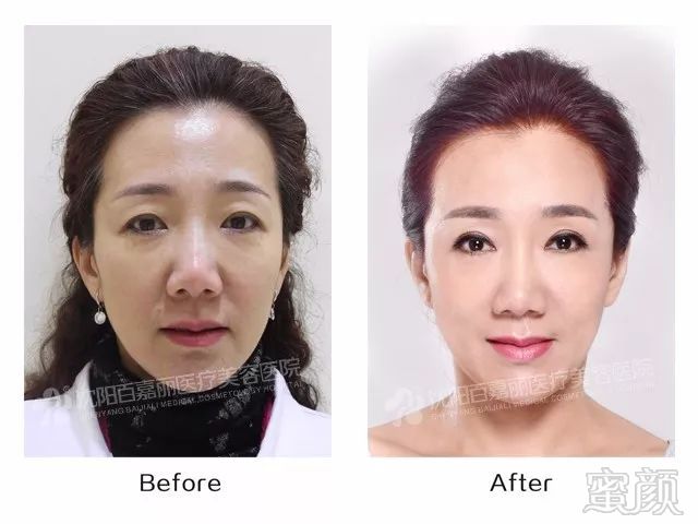 https://img.miyanlife.com/mnt/timg/181117/101042H63-3.jpg