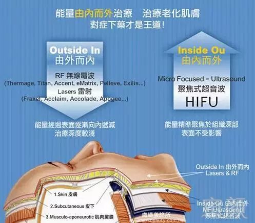 https://img.miyanlife.com/mnt/timg/181117/10155V394-4.jpg