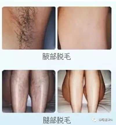 https://img.miyanlife.com/mnt/timg/181117/1035503649-9.jpg