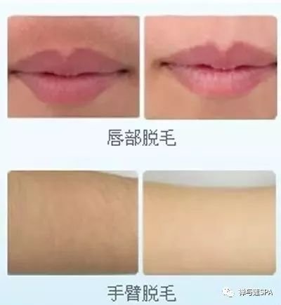 https://img.miyanlife.com/mnt/timg/181117/10355062F-8.jpg