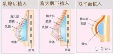 案例图片