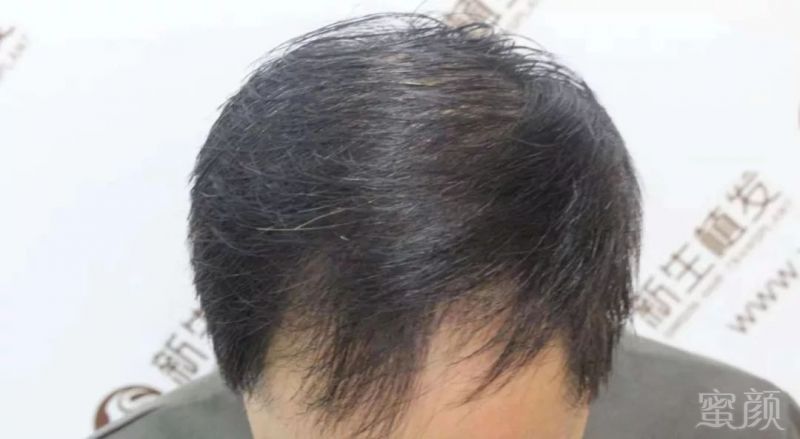 https://img.miyanlife.com/mnt/timg/181118/105925D45-3.jpg