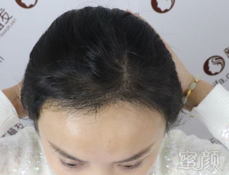 https://img.miyanlife.com/mnt/timg/181118/105SBE0-5.jpg