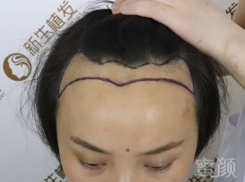 https://img.miyanlife.com/mnt/timg/181118/105SCG1-2.jpg