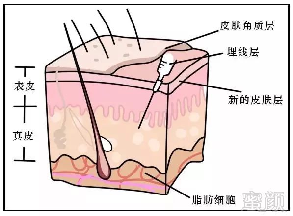 https://img.miyanlife.com/mnt/timg/181118/11013GG2-7.jpg