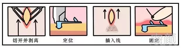 https://img.miyanlife.com/mnt/timg/181118/11013LR8-5.jpg