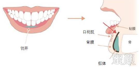 案例图片