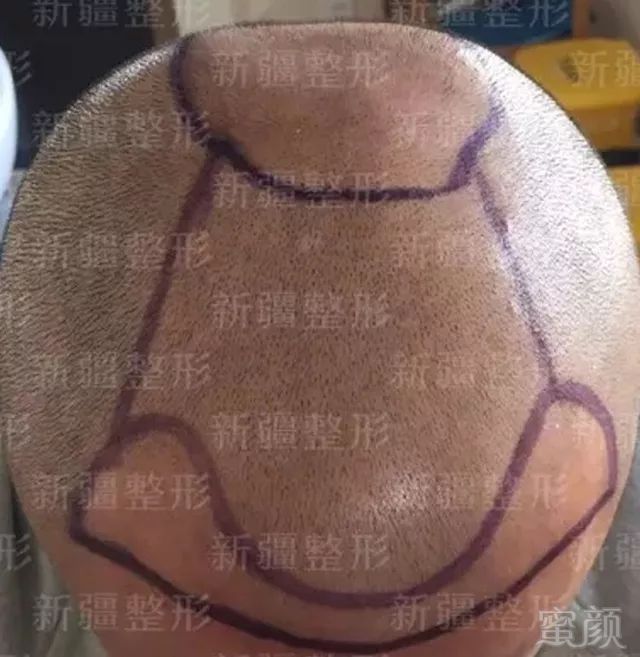 https://img.miyanlife.com/mnt/timg/181118/11361Hb2-0.jpg