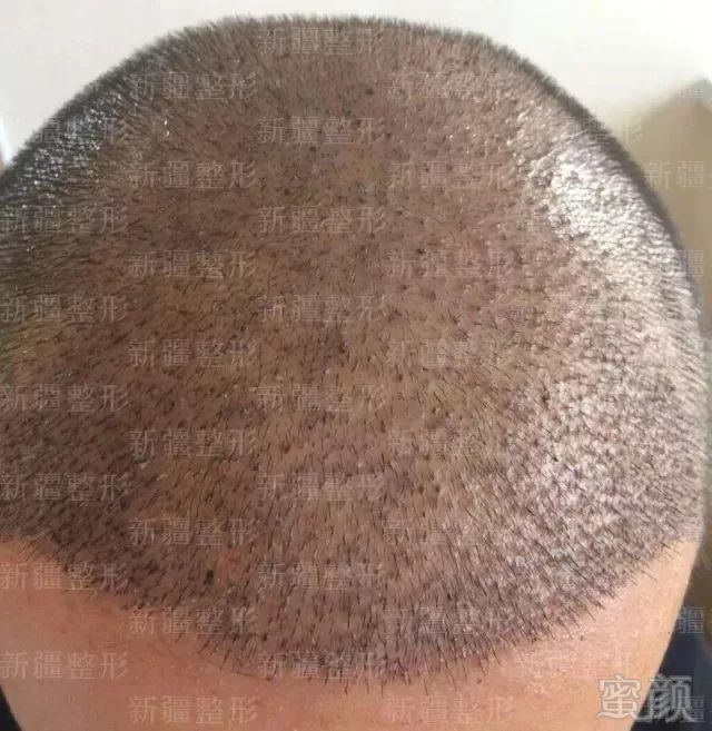 https://img.miyanlife.com/mnt/timg/181118/11361S192-1.jpg