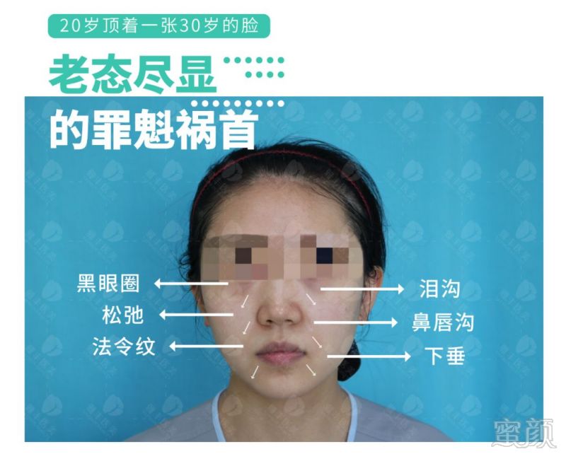 https://img.miyanlife.com/mnt/timg/181118/11391031D-1.jpg