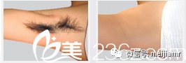 https://img.miyanlife.com/mnt/timg/181118/1141315521-1.jpg