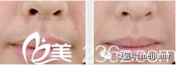 https://img.miyanlife.com/mnt/timg/181118/114131M92-2.jpg