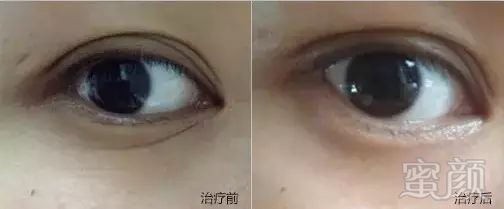 https://img.miyanlife.com/mnt/timg/181118/1145315B9-5.jpg