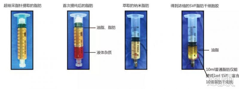 案例图片