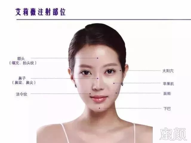https://img.miyanlife.com/mnt/timg/181119/112S56126-0.jpg