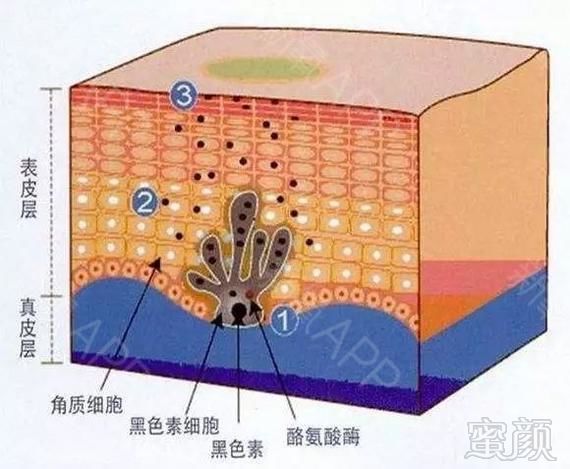 案例图片